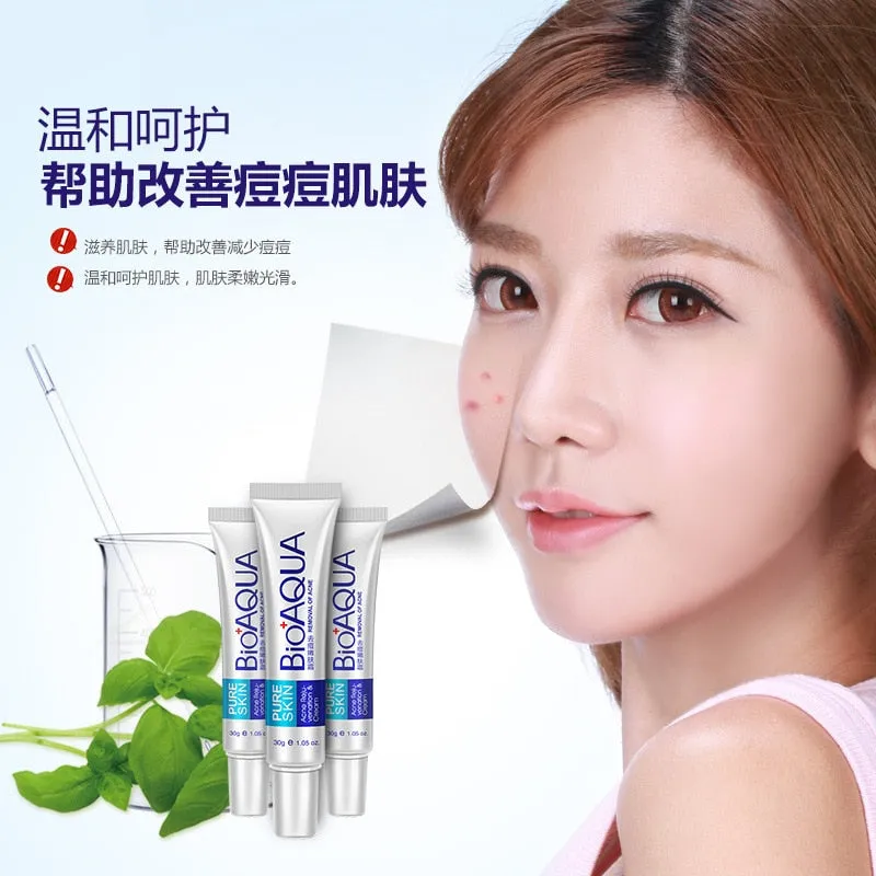 Acne Treatment Blackhead Removal Anti Acne Cream Oil Control